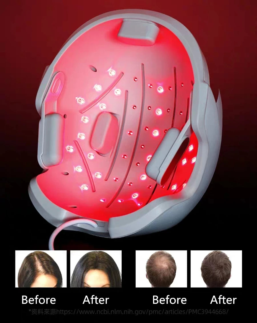 Lescolton Hair Regrow Helmet