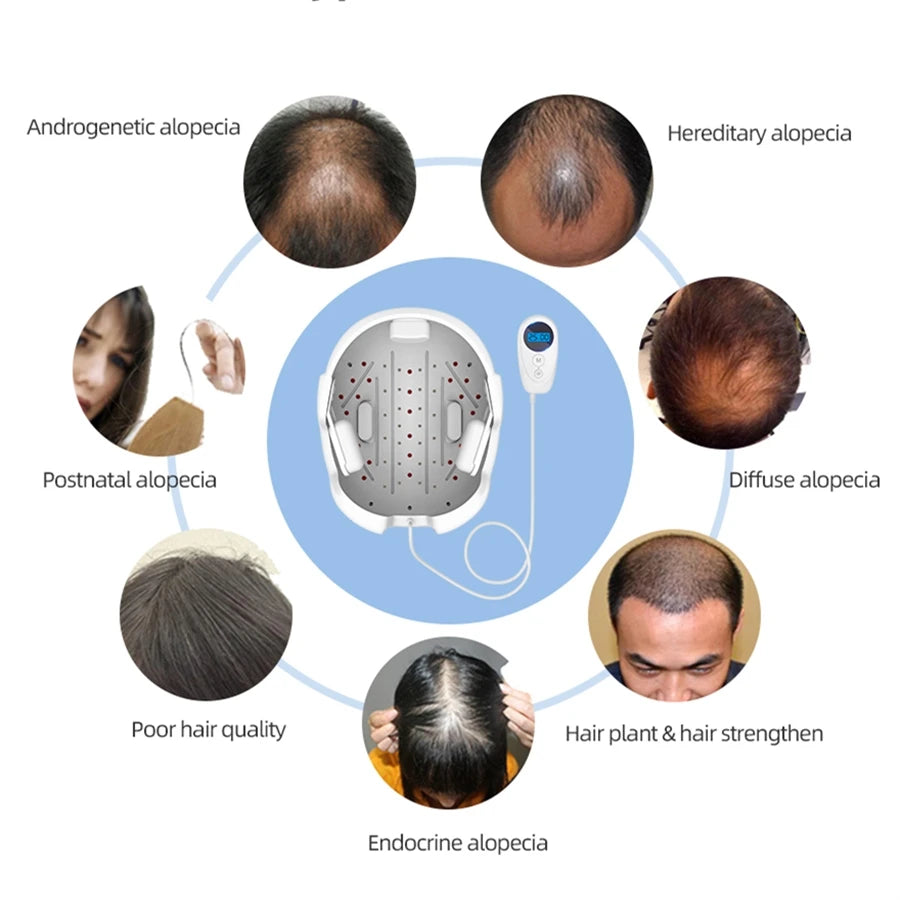Lescolton Hair Regrow Helmet